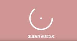 Celebrate Your Scars- Μια κατάθεση ψυχής 